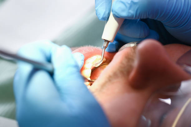 Best Emergency Treatment for Toothache in Thornport, OH