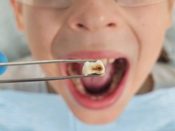 Best Emergency Treatment for Toothache in Thornport, OH